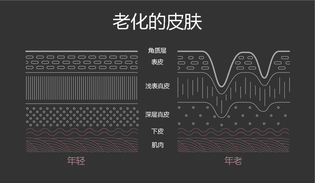 老化的皮肤