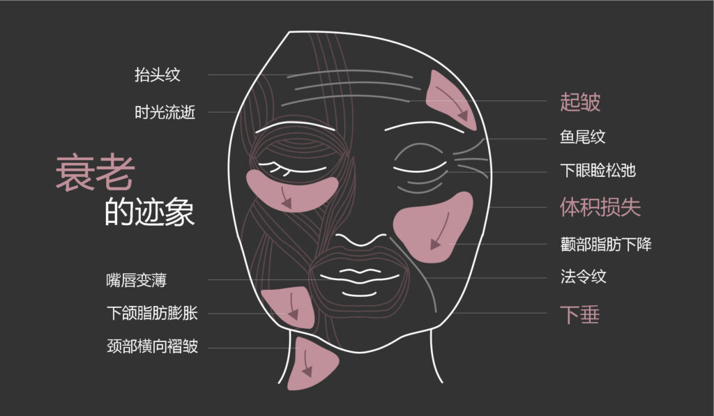 衰老的迹象