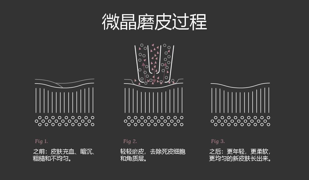 微晶磨皮过程