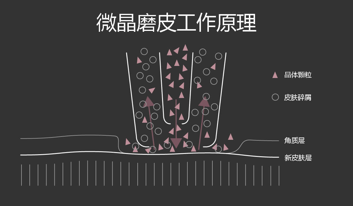 微晶磨皮工作原理