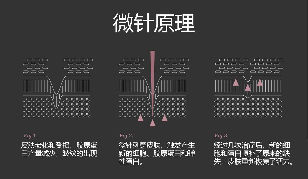 微针的原理