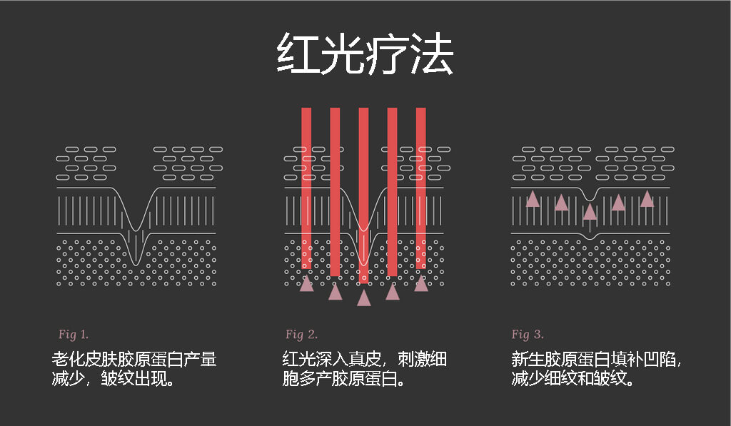 红光疗法