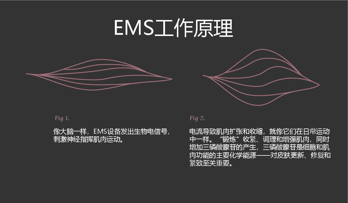 EMS工作原理