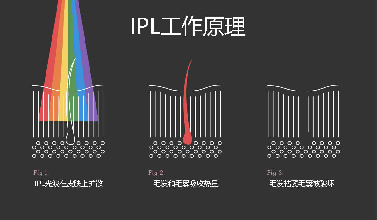 IPL工作原理
