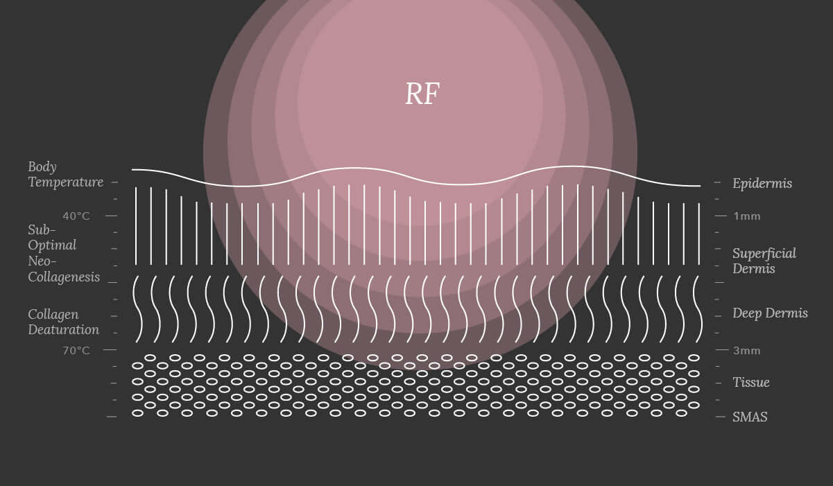 RF的作用范围