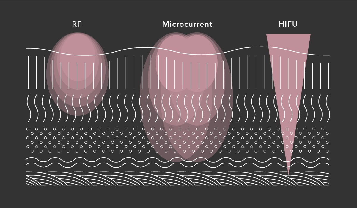RF MICROCURRENT HIFU的作用深度